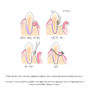 브랜드 블로그